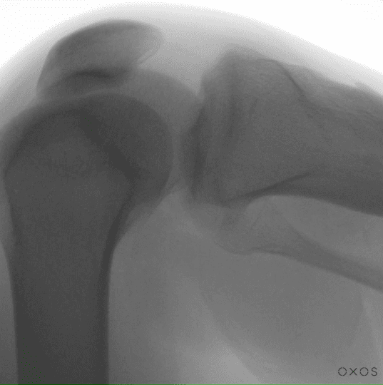 Knee DDR