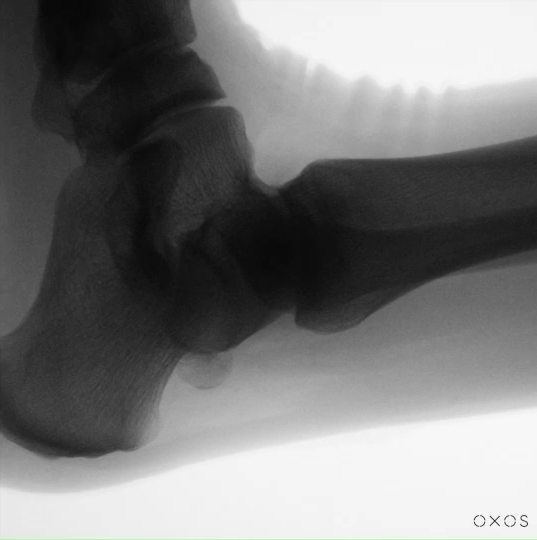 Foot DDR
