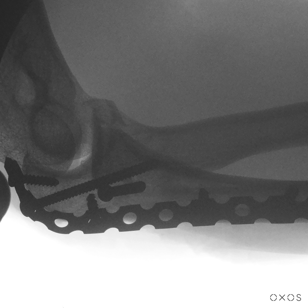 Elbow, Lateral, 9.7 µGy