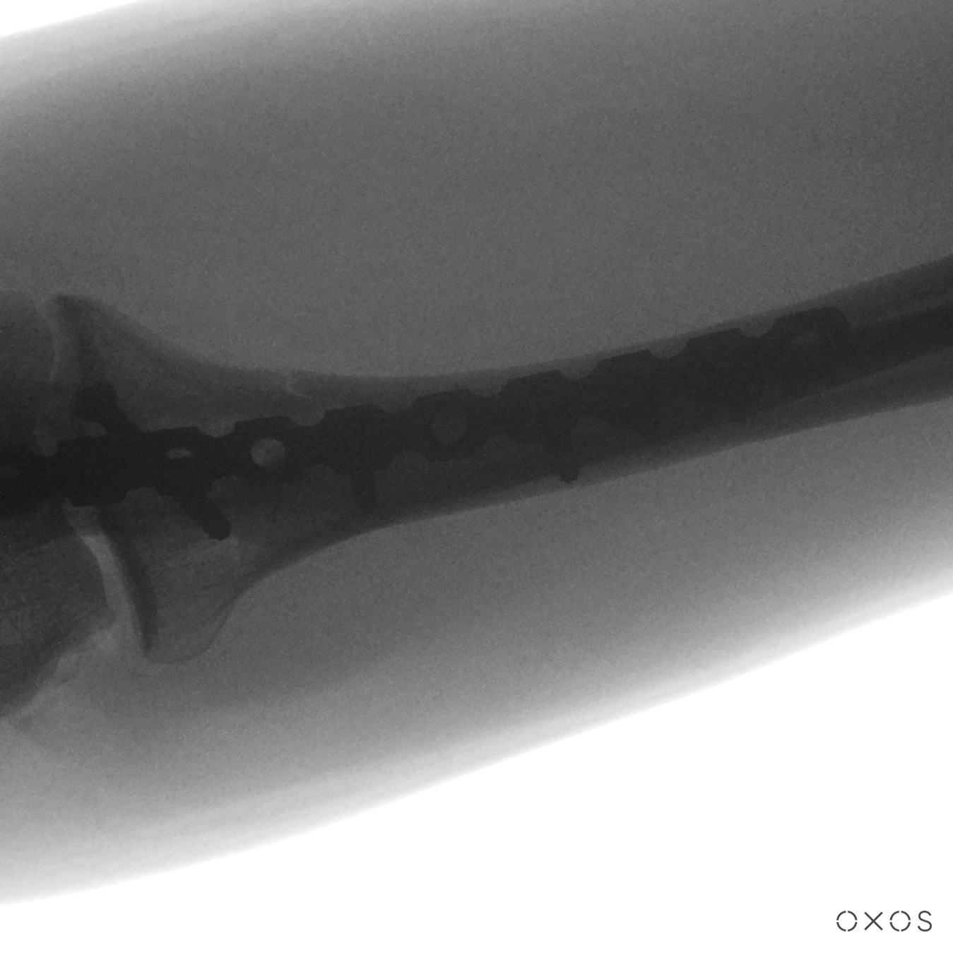 Proximal Ulna, 9.7 µGy
